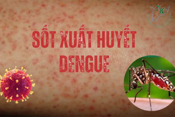 Dịch Bệnh sốt xuất huyết tại Việt Nam